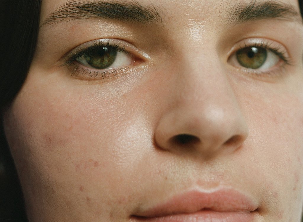 Immunity on the surface